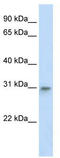 Transcription factor A, mitochondrial antibody, TA341819, Origene, Western Blot image 