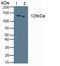 Collagen Type I Alpha 2 Chain antibody, LS-C372491, Lifespan Biosciences, Western Blot image 