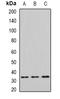 Eukaryotic Translation Initiation Factor 2B Subunit Alpha antibody, orb341384, Biorbyt, Western Blot image 