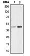 PTGES3L-AARSD1 Readthrough antibody, MBS820579, MyBioSource, Western Blot image 