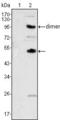 Colony Stimulating Factor 1 antibody, MA5-15599, Invitrogen Antibodies, Western Blot image 