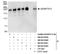 ADAMTS13 antibody, NB100-55262, Novus Biologicals, Western Blot image 