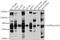 Ectonucleoside Triphosphate Diphosphohydrolase 1 antibody, GTX57161, GeneTex, Western Blot image 