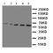 Solute Carrier Family 22 Member 5 antibody, LS-C313281, Lifespan Biosciences, Western Blot image 