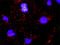 Cadherin 1 antibody, LS-B4297, Lifespan Biosciences, Proximity Ligation Assay image 