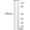 Phosphorylated Adaptor For RNA Export antibody, A08772, Boster Biological Technology, Western Blot image 