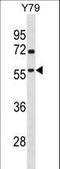 TATA-Box Binding Protein Associated Factor, RNA Polymerase I Subunit A antibody, LS-C161686, Lifespan Biosciences, Western Blot image 