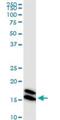 NME/NM23 Nucleoside Diphosphate Kinase 1 antibody, H00004830-M02, Novus Biologicals, Western Blot image 