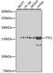 Forkhead Box E1 antibody, STJ110062, St John