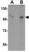 Zinc finger MIZ domain-containing protein 2 antibody, GTX31831, GeneTex, Western Blot image 