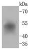 FosB Proto-Oncogene, AP-1 Transcription Factor Subunit antibody, A01569, Boster Biological Technology, Western Blot image 