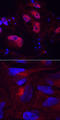 Lysine Demethylase 6B antibody, AF7300, R&D Systems, Immunocytochemistry image 