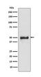 Keratin 8 antibody, M01421-2, Boster Biological Technology, Western Blot image 
