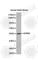 Adrenoceptor Beta 2 antibody, A2048, ABclonal Technology, Western Blot image 