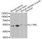 Interleukin 11 Receptor Subunit Alpha antibody, A6627, ABclonal Technology, Western Blot image 