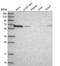 Copine 1 antibody, NBP2-54980, Novus Biologicals, Western Blot image 