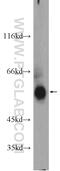 Kelch Like Family Member 42 antibody, 24847-1-AP, Proteintech Group, Western Blot image 