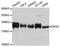 Desmoglein 2 antibody, A9480, ABclonal Technology, Western Blot image 