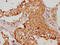 3-Hydroxy-3-Methylglutaryl-CoA Lyase antibody, CSB-PA010563LA01HU, Cusabio, Immunohistochemistry frozen image 