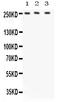 ATP Binding Cassette Subfamily A Member 1 antibody, PB9467, Boster Biological Technology, Western Blot image 