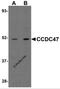 Coiled-Coil Domain Containing 47 antibody, 5511, ProSci, Western Blot image 