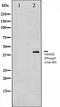 Histone Deacetylase 8 antibody, orb106280, Biorbyt, Western Blot image 