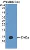 Anoctamin 6 antibody, LS-C373401, Lifespan Biosciences, Western Blot image 