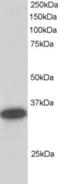 Carbonyl Reductase 1 antibody, STJ70207, St John