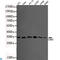 Cyclin Dependent Kinase 5 antibody, LS-C812912, Lifespan Biosciences, Western Blot image 