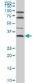 Epithelial Stromal Interaction 1 antibody, H00094240-M01, Novus Biologicals, Western Blot image 