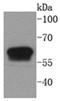 Keratin 6A antibody, A04012-1, Boster Biological Technology, Western Blot image 