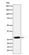 Goosecoid Homeobox antibody, M03084-2, Boster Biological Technology, Western Blot image 