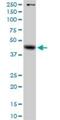 Galactosidase Alpha antibody, H00002717-D01P, Novus Biologicals, Western Blot image 