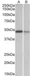 Thioredoxin Domain Containing 5 antibody, EB10879, Everest Biotech, Western Blot image 