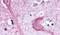 KISS1 Receptor antibody, PA5-33880, Invitrogen Antibodies, Immunohistochemistry paraffin image 