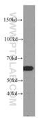 Chaperonin Containing TCP1 Subunit 3 antibody, 60264-1-Ig, Proteintech Group, Western Blot image 