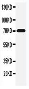 Solute Carrier Family 6 Member 4 antibody, PA1706, Boster Biological Technology, Western Blot image 