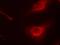 Cofilin 1 antibody, GTX50199, GeneTex, Immunocytochemistry image 