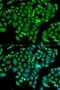 Chromatin Assembly Factor 1 Subunit B antibody, LS-C335645, Lifespan Biosciences, Immunofluorescence image 