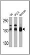 Disks large homolog 1 antibody, NB600-1229, Novus Biologicals, Western Blot image 