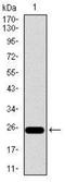 Integrin Subunit Beta 4 antibody, NBP2-37392, Novus Biologicals, Western Blot image 