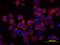 Interleukin 6 Signal Transducer antibody, MA5-23922, Invitrogen Antibodies, Immunocytochemistry image 