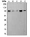 Ribosomal Protein S6 Kinase B1 antibody, LS-C352828, Lifespan Biosciences, Western Blot image 