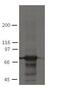 Plakophilin 1 antibody, MA5-18082, Invitrogen Antibodies, Western Blot image 