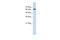 Eukaryotic Translation Initiation Factor 2D antibody, A11205, Boster Biological Technology, Western Blot image 