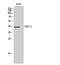 Carbohydrate Sulfotransferase 13 antibody, GTX34311, GeneTex, Western Blot image 