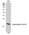 Histone H3 antibody, STJ90122, St John