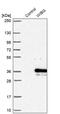 PYM Homolog 1, Exon Junction Complex Associated Factor antibody, PA5-61181, Invitrogen Antibodies, Western Blot image 