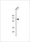 Ligand Dependent Nuclear Receptor Corepressor Like antibody, 59-139, ProSci, Western Blot image 