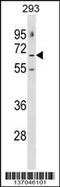 Gamma-Aminobutyric Acid Type A Receptor Epsilon Subunit antibody, 58-946, ProSci, Western Blot image 